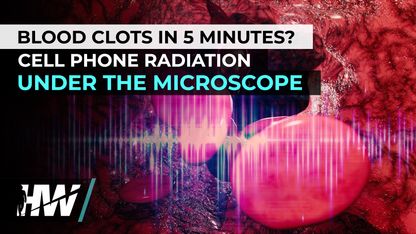 BLOOD CLOTS IN 5 MINUTES? CELL PHONE RADIATION UNDER THE MICROSCOPE