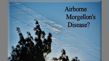 AIRBORNE MORGELLON'S DISEASE?