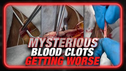 BREAKING: Funeral Home Director Warns Mysterious Blood Clots Getting Worse